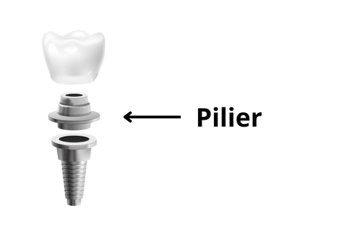Pilier prothétique connecteur implant dentaire