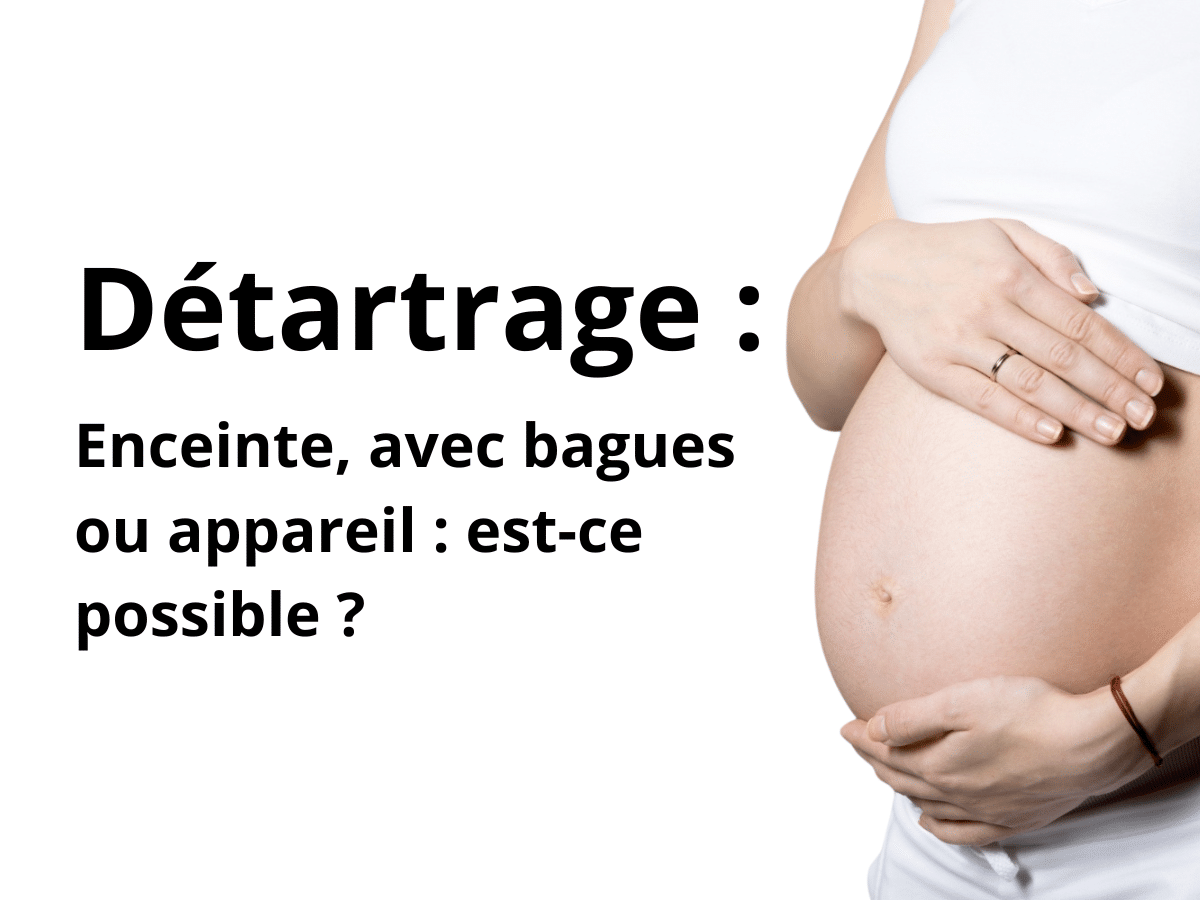 Détartrage enceinte, avec bagues ou appareil : est-ce possible ?