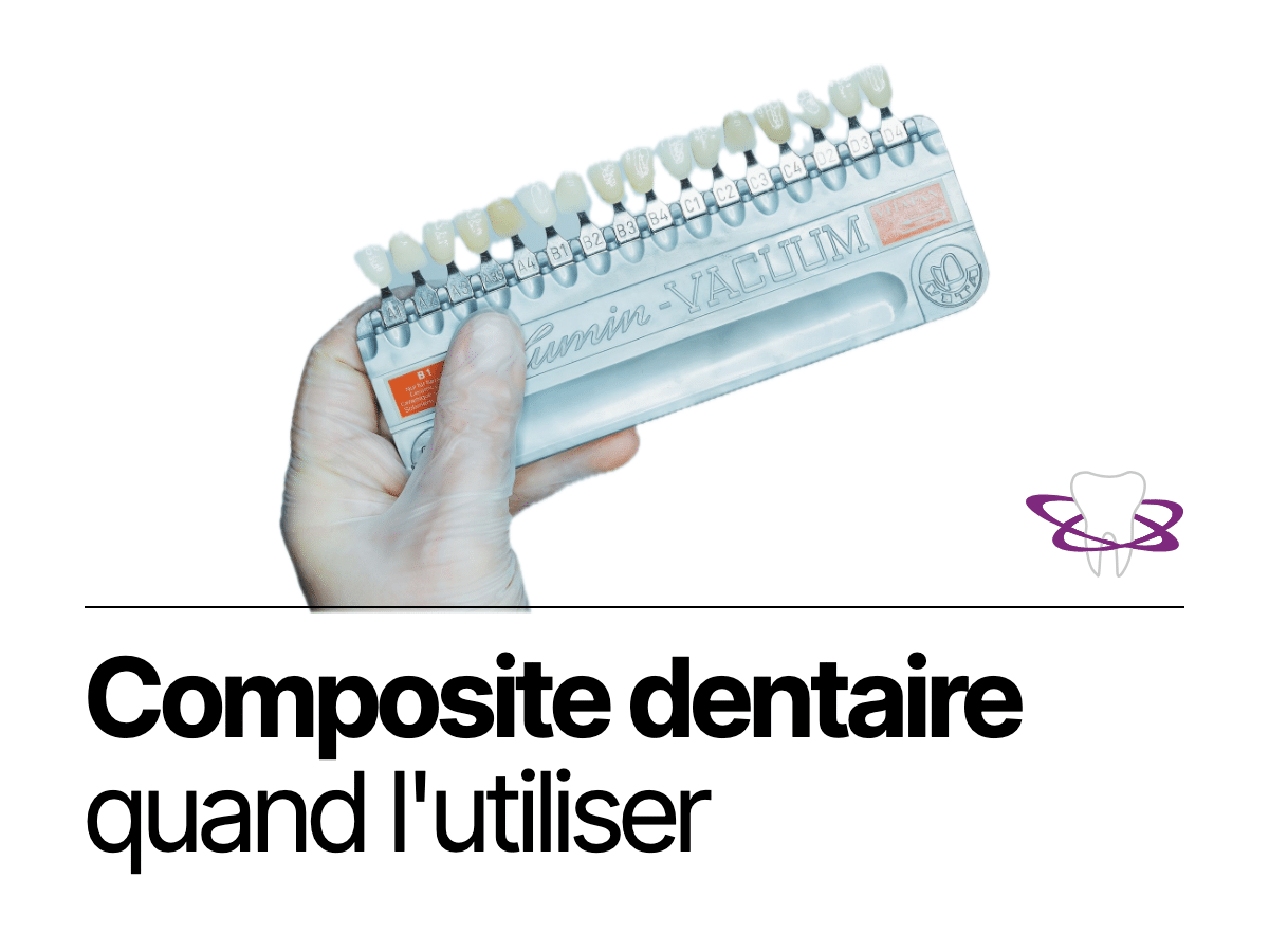 Composite dentaire : c'est quoi et quand l'utiliser ? - Cabinet Dentaire Bontemps