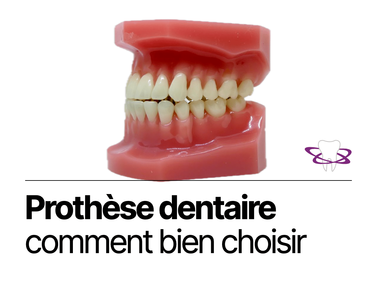 Prothèse dentaire : les types et comment bien choisir - Cabinet Dentaire Bontemps