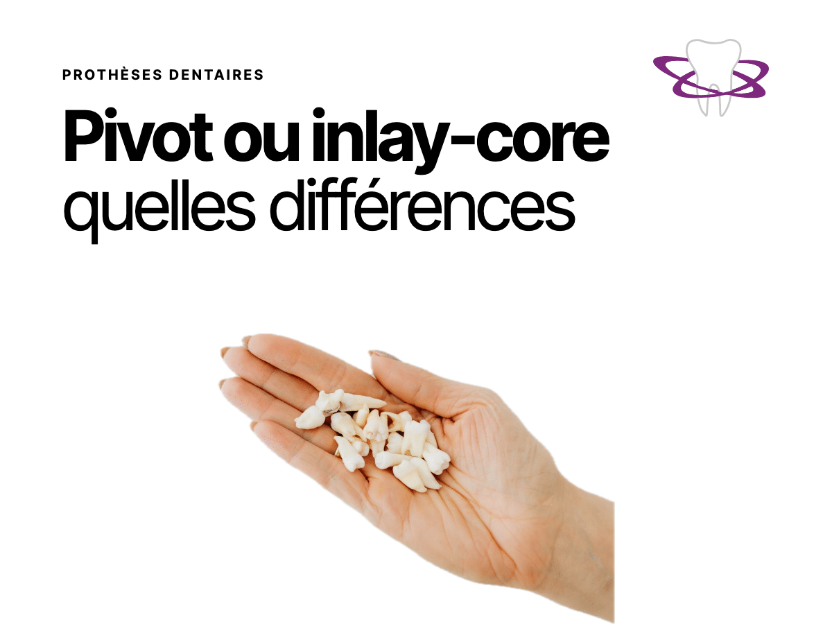 Pivot dentaire vs inlay-core : différences et indications - Cabinet Dentaire Bontemps
