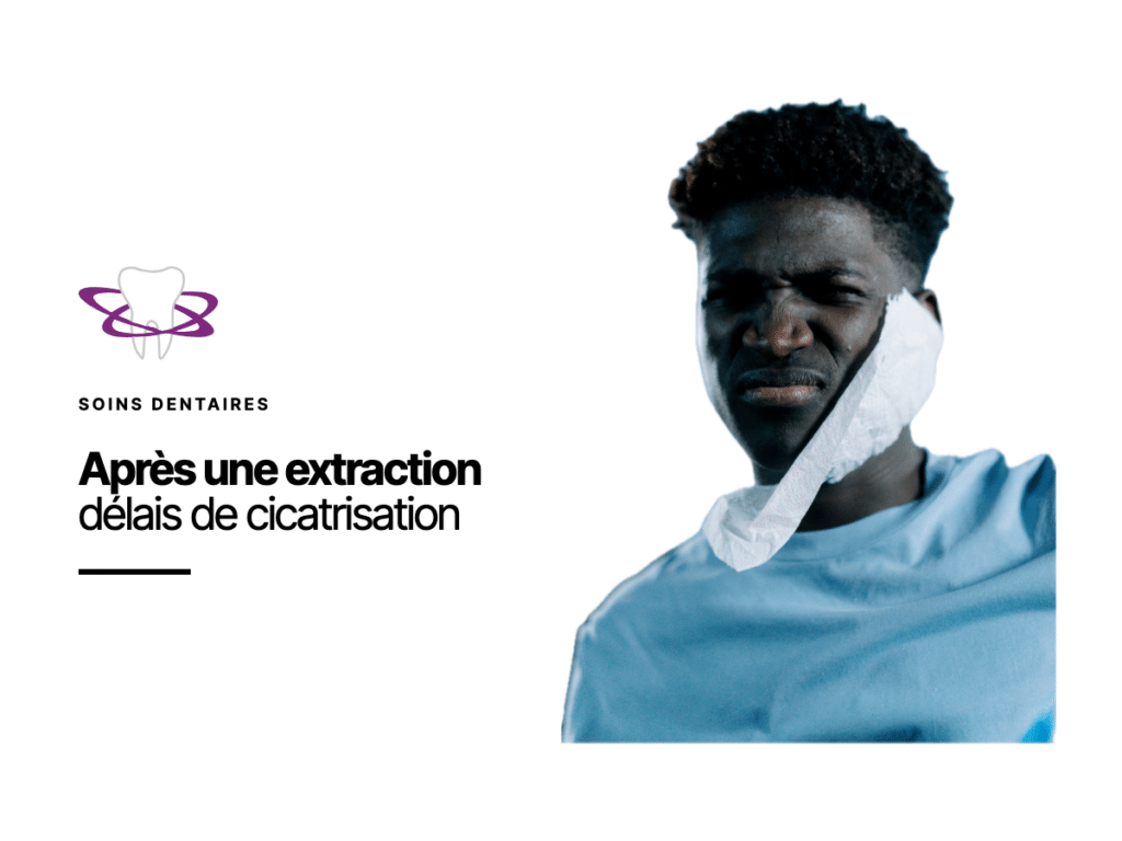 Cicatrisation après extraction dentaire : délais et étapes